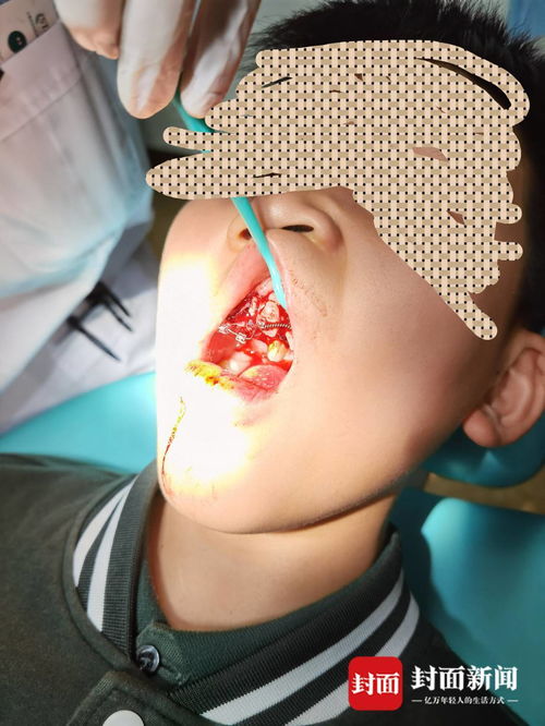 重慶特斯拉車主遭遇驚魂一幕 停車時車輛自動加速撞墻，致孩子受傷